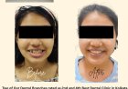 Teeth Care Multispeciality Dental Clinic Being the Best Dental Braces Center in Kolkata